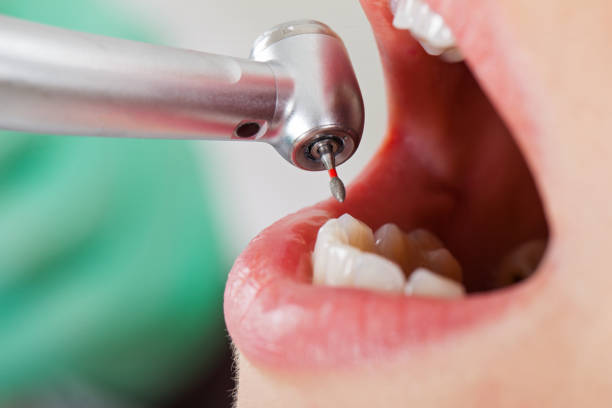 Best Emergency Root Canal Treatment in Ddanelle, AR